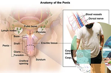 Sherman Expert on Risks & Outcomes of Penile Implant Procedures